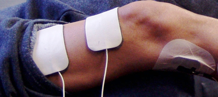 StimBits: Neuromuscular Electrical Stimulation (NMES) in rehabilitation